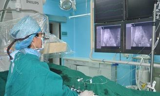 心脏造影怎么做 心脏照影的做法