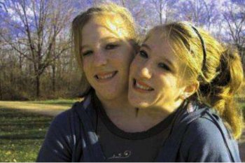 ����˫ͷ�� ���ȸǶ��Ͳ�������һ����������ͷ