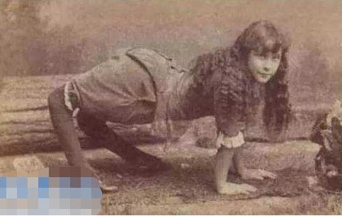 网传的福岛核泄漏后变异女人图片 部分孕妇怀的孩子变异了