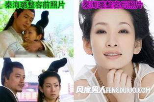 秦海璐整过容吗 确实做过微整容