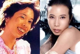 蔡思贝龅牙是真的吗 牙套效果并不是真的
