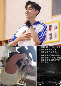 james李铢衔的手怎么了 左手手腕有伤痕