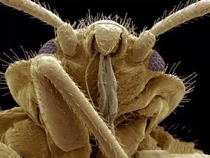 ����ΪʲôͻȻ�д�ʭ �п������������Ⱦ�ϴ�ʭ