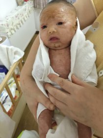 ���޽�Ӥ������ô���� ������ô���µ�