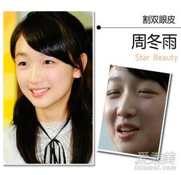 ����Ϫ˫��Ƥ�Ǹ���� ��˫��Ƥ����ͦ��Ȼ��