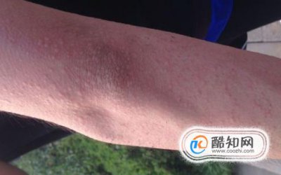 �����Ĺ�����ݡ����ı���֢״ ����ݡ�����������