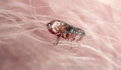 ����һ��ҧ���˶������� Ϊʲôҧ����ô������ô��