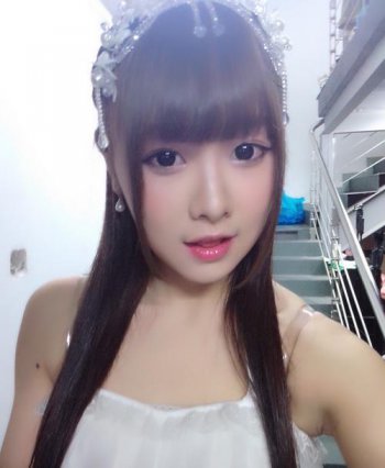 唐安琪怎么了 snh48唐安琪烧伤事件震惊娱乐圈