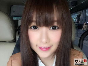 唐安琪怎么了 snh48唐安琪烧伤事件震惊娱乐圈