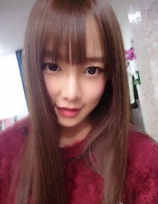 唐安琪怎么了 snh48唐安琪烧伤事件震惊娱乐圈
