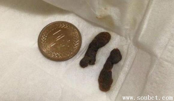 ���������Ķ�ʺ��Ȼ��Ӳ�Ҵ� ���Ķ�ʺ�ж��