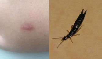 �����ҧ����ʲô��Ӧ ���ռ�Ϊ�ֲ�����ȥ