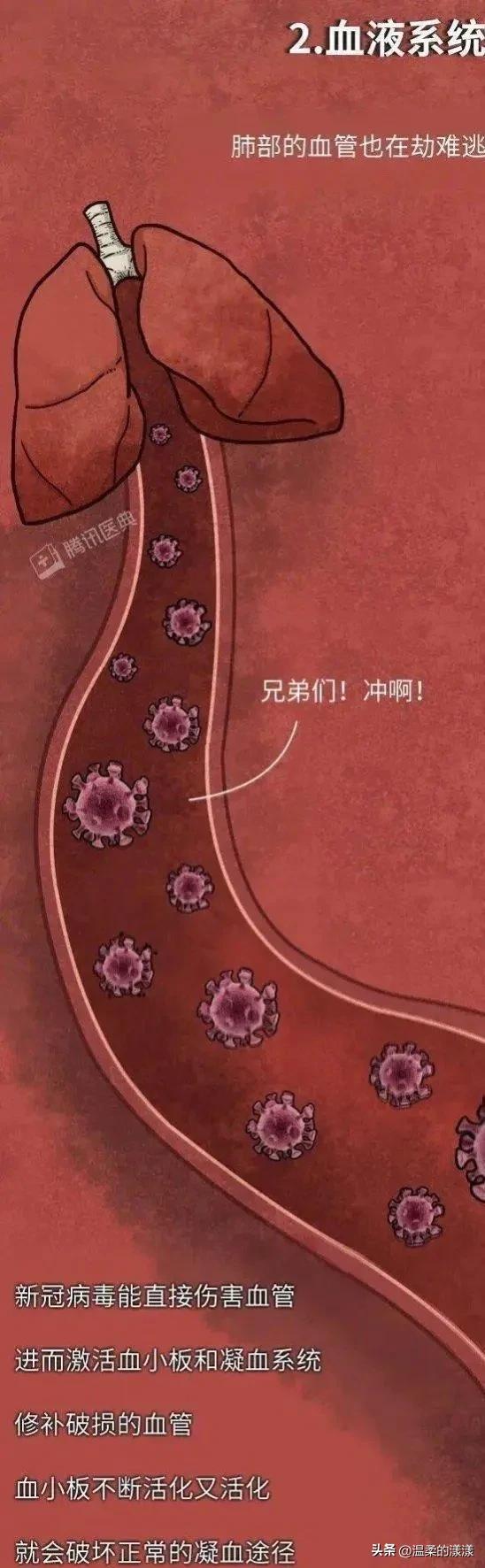 新冠疫情后遗症有多可怕 主要会减弱劳动力