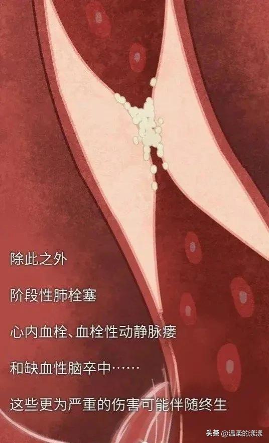 新冠疫情后遗症有多可怕 主要会减弱劳动力