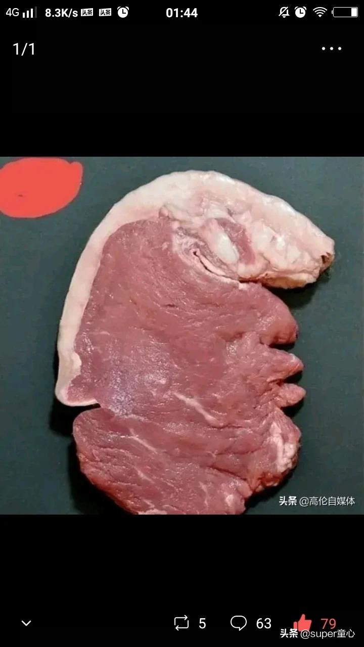 疫情什么时候才能彻底结束 有两点是非常重要的