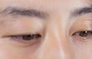 ��Ƥ����Ԥ�� ��ϸ��һ����Ƥ������Ԥ��