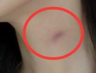 ��Ů�����ֲ�ݮ�ļ��� �ֲ�ݮ��ԭ��