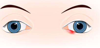 ����Ƥ������Ԥ�� �����������������ֵ�˵��