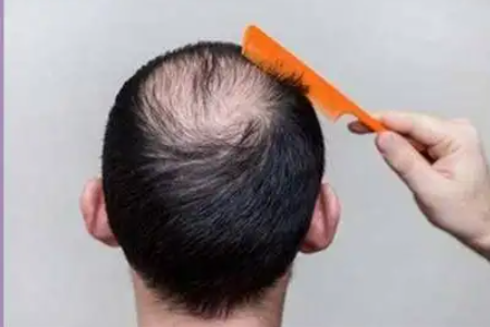 �����ѷ����ط� ���Ӻ����䷢