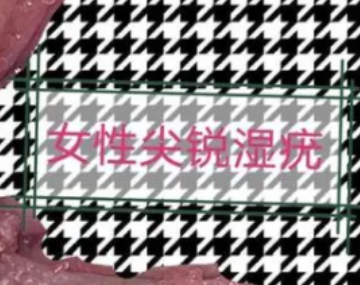 ����ʪ��ͼ֢״Ů �����ļ����Ƿǳ����