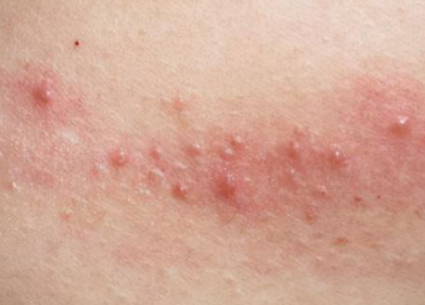 Ů�˰��̲�������֢״ͼƬ Ů�˰��̲�����������