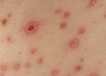 Ů�˰��̲�������֢״ͼƬ Ů�˰��̲�����������