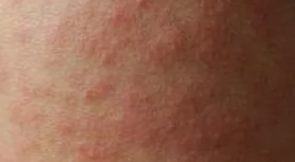 Ů�˰��̲�������֢״ͼƬ Ů�˰��̲�����������