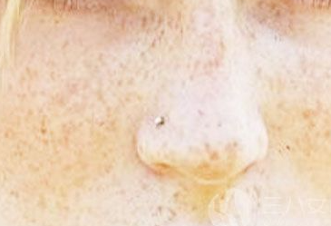 �����˵����ϳ����˶��������ǰߵ� �沿���ְߵ�ͼƬ