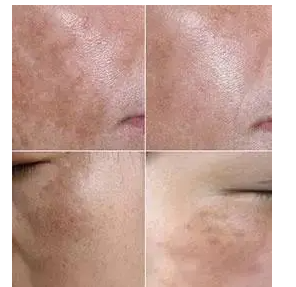 �����˵����ϳ����˶��������ǰߵ� �沿���ְߵ�ͼƬ