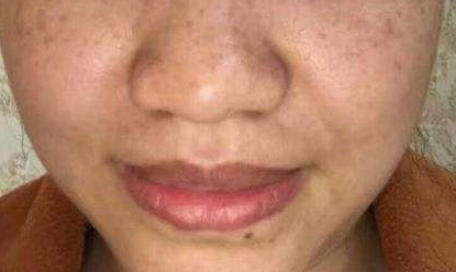 �����˵����ϳ����˶��������ǰߵ� �沿���ְߵ�ͼƬ