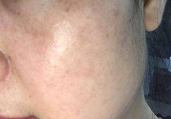 �����˵����ϳ����˶��������ǰߵ� �沿���ְߵ�ͼƬ