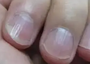 ��ָ�׳���������ʲôԭ�� ��������������