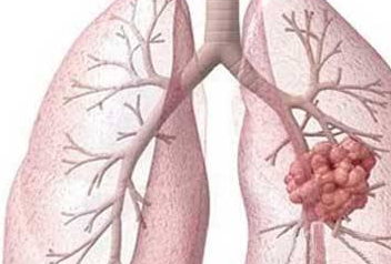 ���Ƶ�Σ�� Ϊ������һ����һ��֤���Լ�����