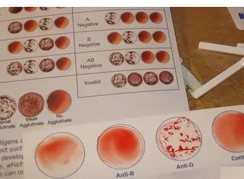 血型配对表图 输血血型配对