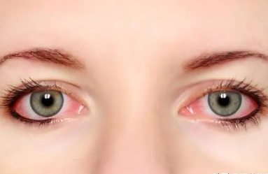 女右眼皮跳真的有预兆 眼皮跳测吉凶是真的吗