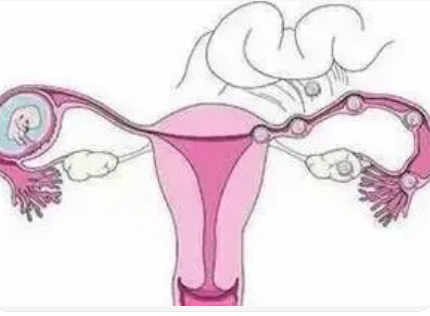 15�ֳ����ĸ��Ƽ��� 6��Ԥ�����Ƽ����ķ���