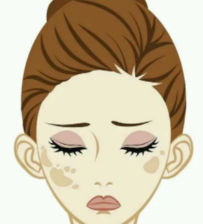 �����ϵİߵ����ȥ�� ѡ����ʵķ�ʽ�������