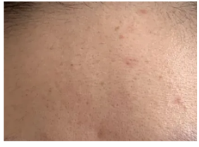 ̧ͷ��̫������ô�� ����������¶�ͷ