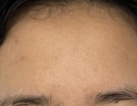 ̧ͷ��̫������ô�� ����������¶�ͷ