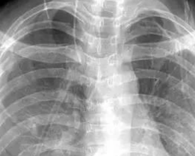 ct��������˺��ж�� ��ʵ�ܰ�ȫ