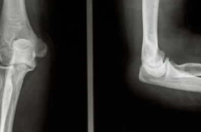 ���°��г�����ʲôӰ�� ϥ�ؽڰ��°�������ô����