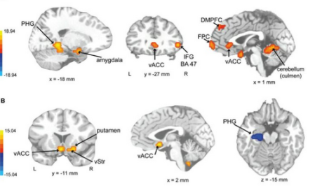 ��Щ��Ҳ�����й�����ЧӦ ʲô�Ǻ���ЧӦ