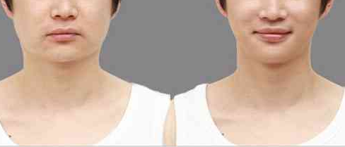 ����һ���ڿ������� �����Լ��Ĳ�����