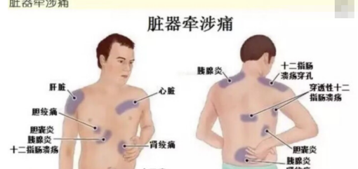 ���屳����ʹ��Ӧ���� ����Ҫ�������־���