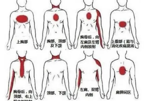 ���屳����ʹ��Ӧ���� ����Ҫ�������־���