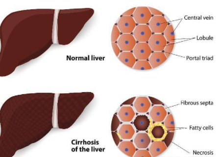 ���಻�ñ��6��ʳ�� ��Ӧ��ʳ�õ�ʳ��