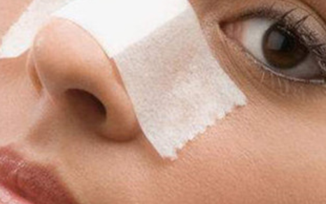 ��ôȥ��ݮ�� ��ô������ȥ����ݮ��