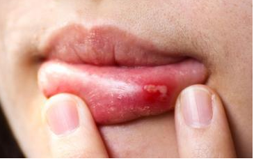 ��ǻ������ô��������� ��ʲô�õĿ죨��ҩ��Ч�죩