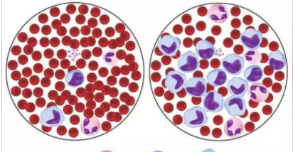 Ѫ�ͱ�����ߵ���ʲô ������ߵ���O��Ѫ