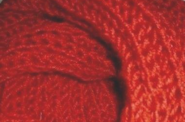 ����Χ���ĸ���֯�� Χ����֯���кܶ���